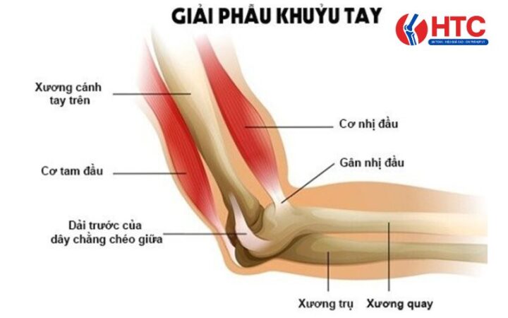 Hội Chứng Tennis Elbow Là Gì: Tổng Quan Từ A Đến Z Về Chấn Thương Khuỷu Tay